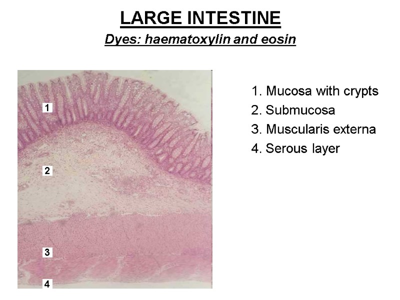 LARGE INTESTINE  Dyes: haematoxylin and eosin  1. Mucosa with crypts 2. Submucosa